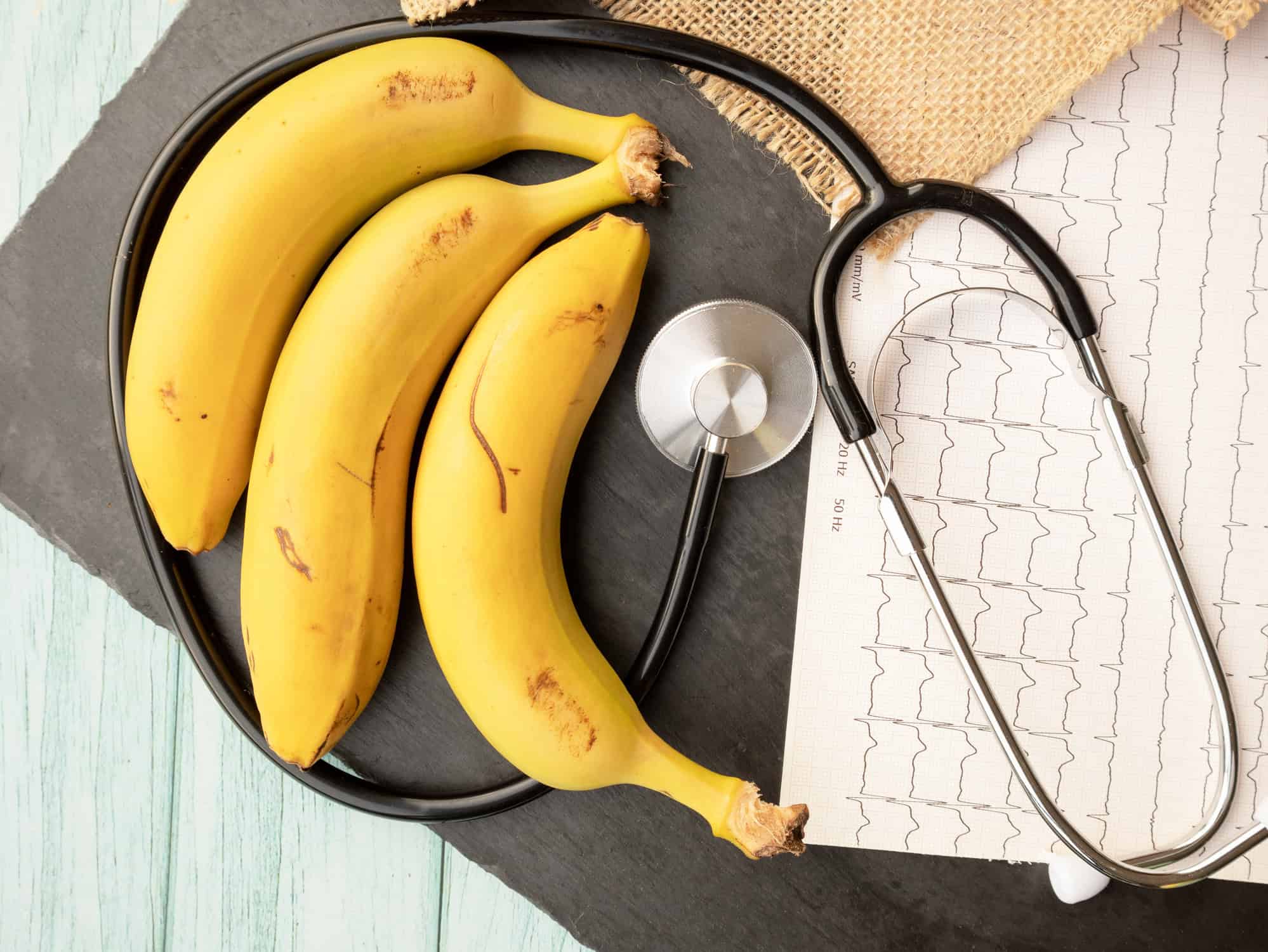 smartwatch-aponta-batimentos-cardiacos-em-banana;-veja-a-explicacao